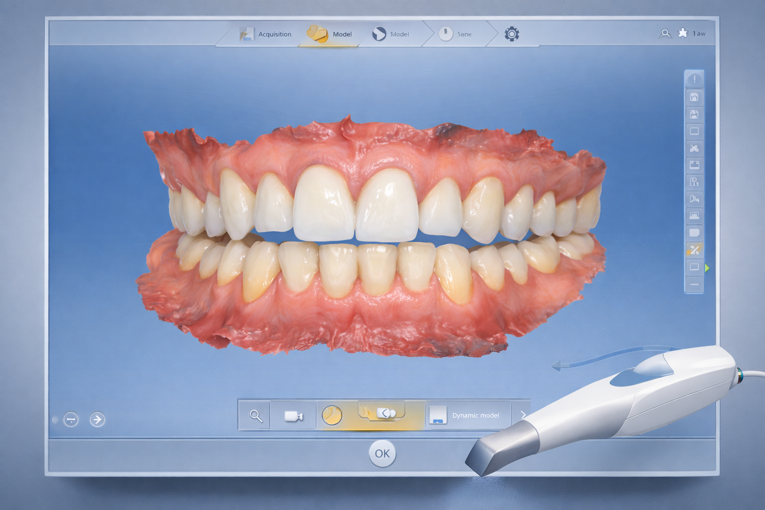 Digital 3D impression scan of teeth created with a CEREC scanner for accurate, comfortable dental impressions