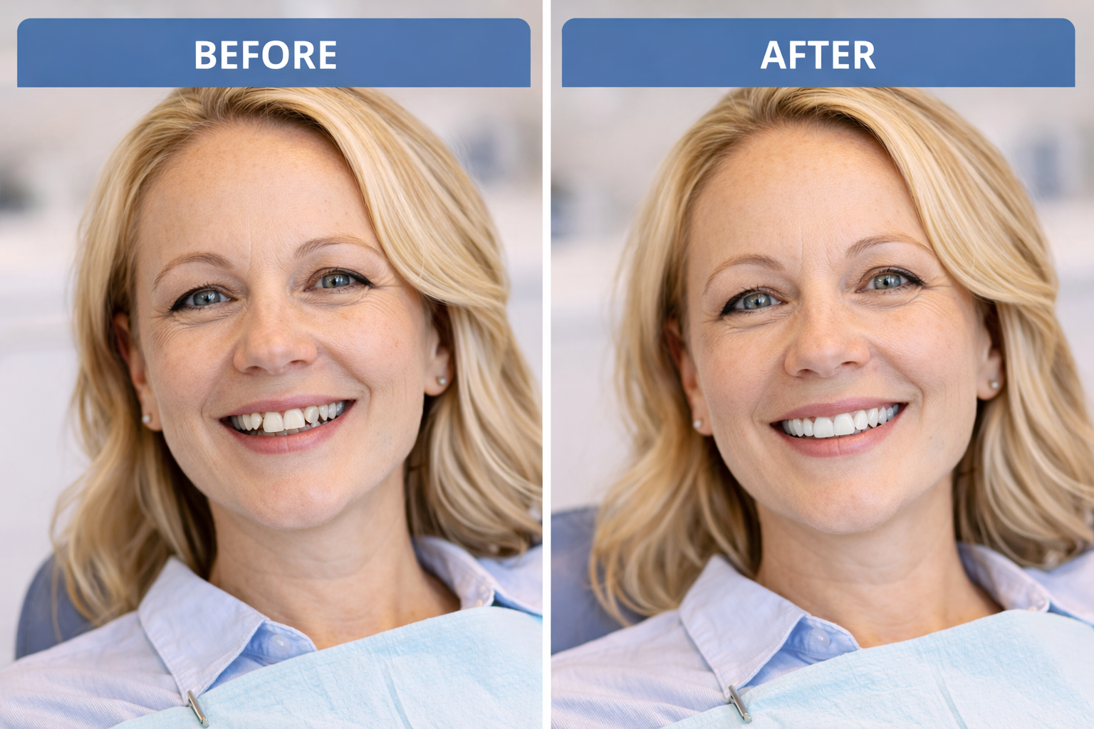 Before and after dental smile transformation showing improved comfort and results made possible with oral conscious sedation dentistry
